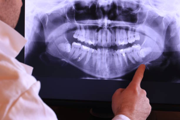 Best Emergency Treatment for Oral Infections in Heritage Lake, IN